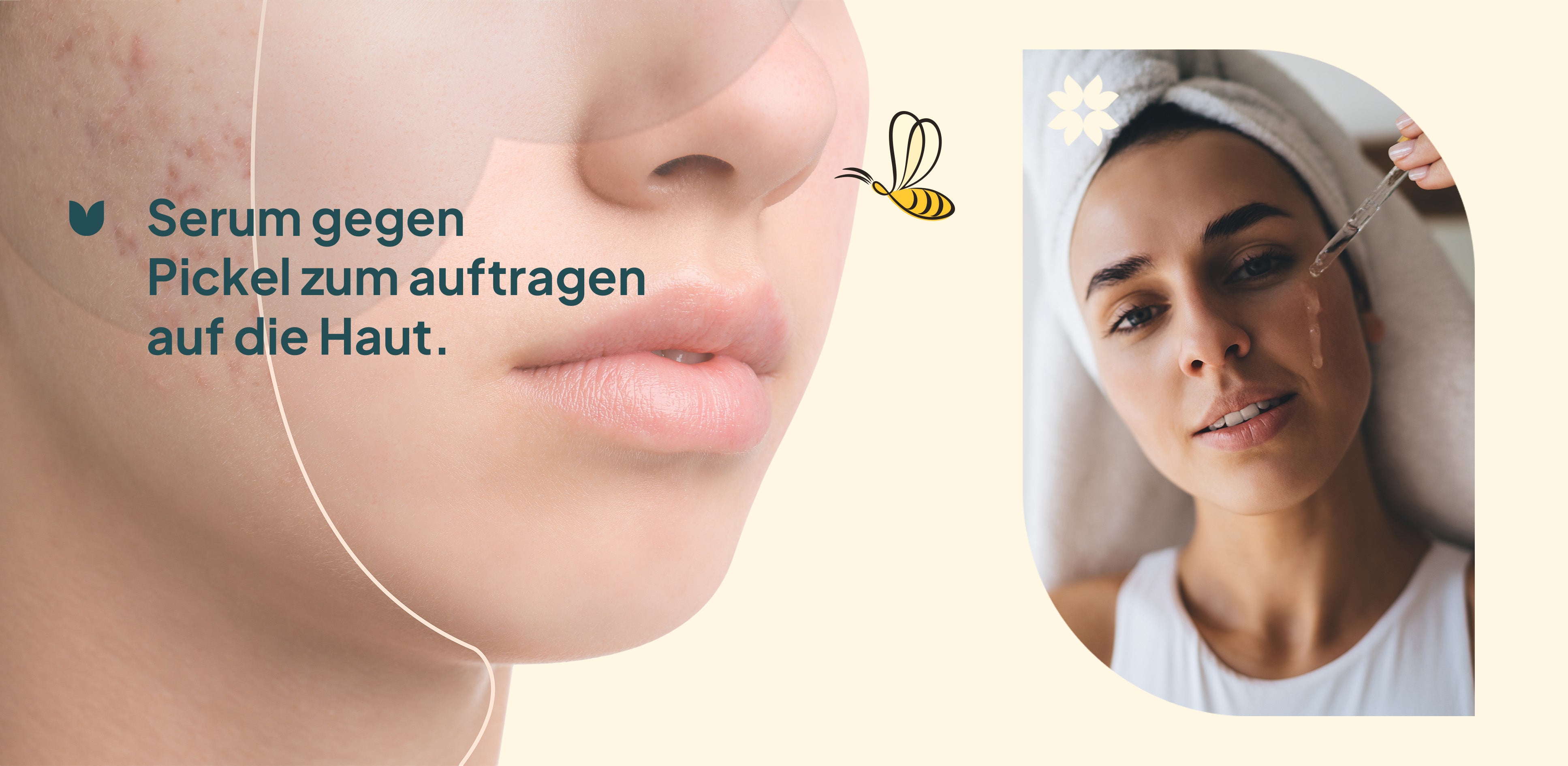 Anti- Pickel Serum A+ 2