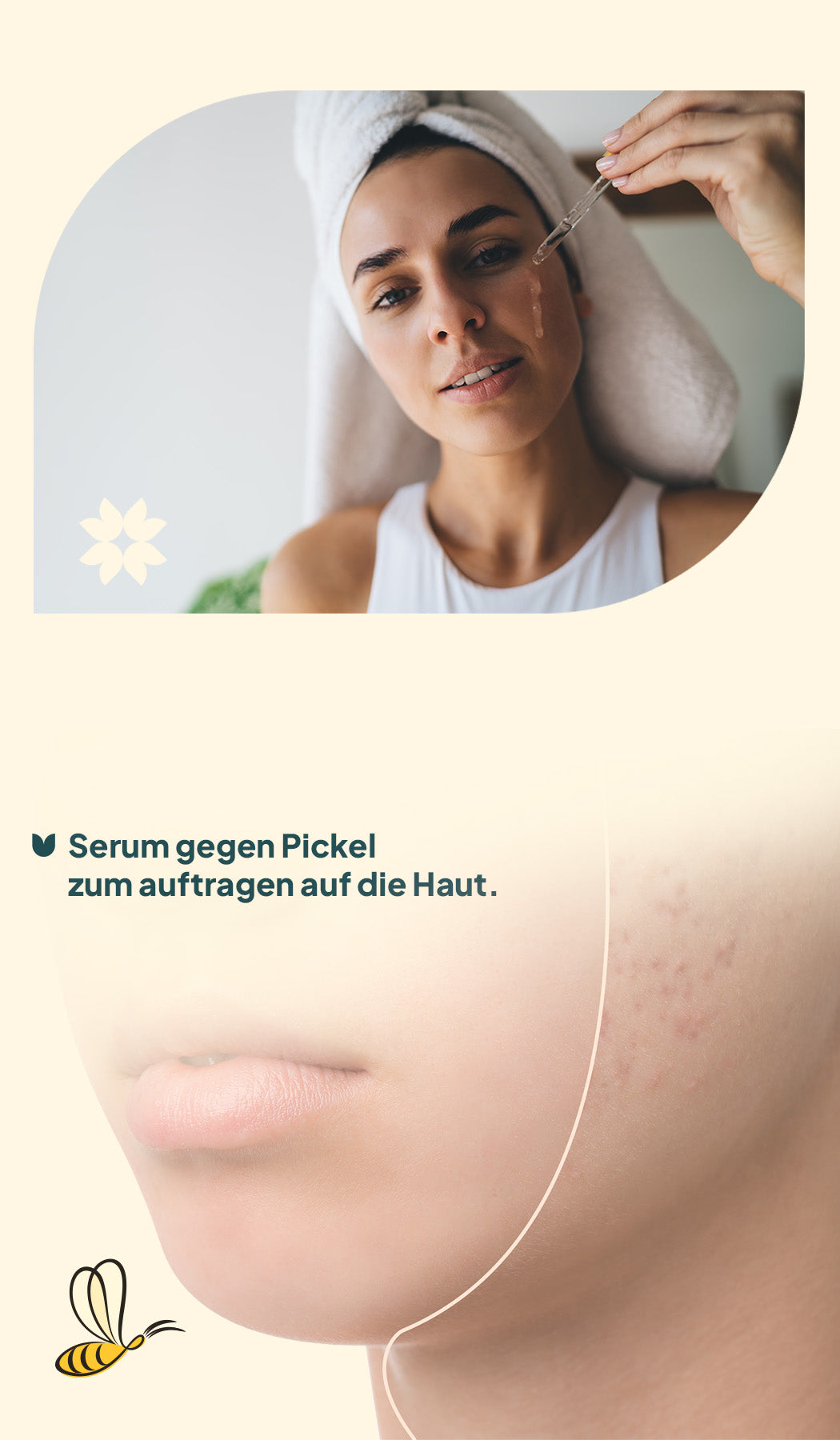 Anti- Pickel Serum A+ 2